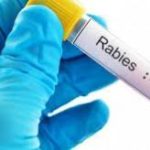 Get Rabies Vaccine in kathmandu Nepal. Clinic One