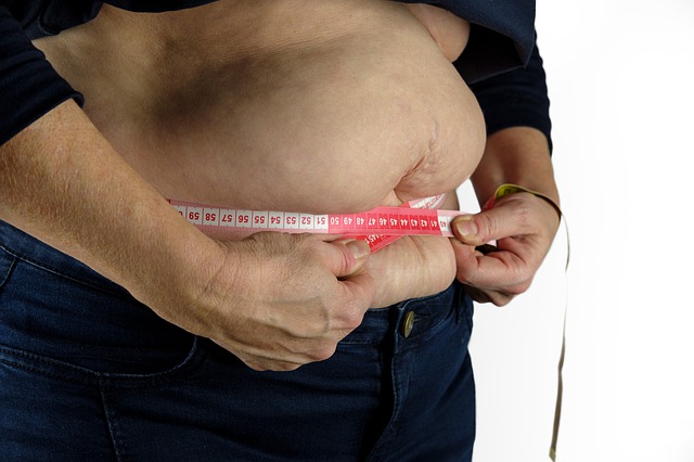 Obesity and other causes of diabetes in Nepal 