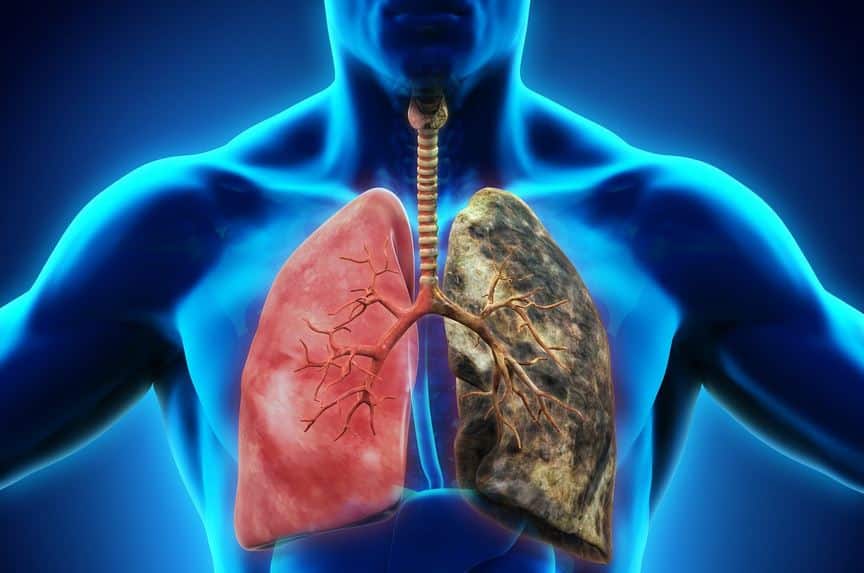 Top 8 Respiratory Diseases in Nepal