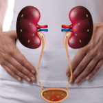 Urinary tract infection treatment in nepal