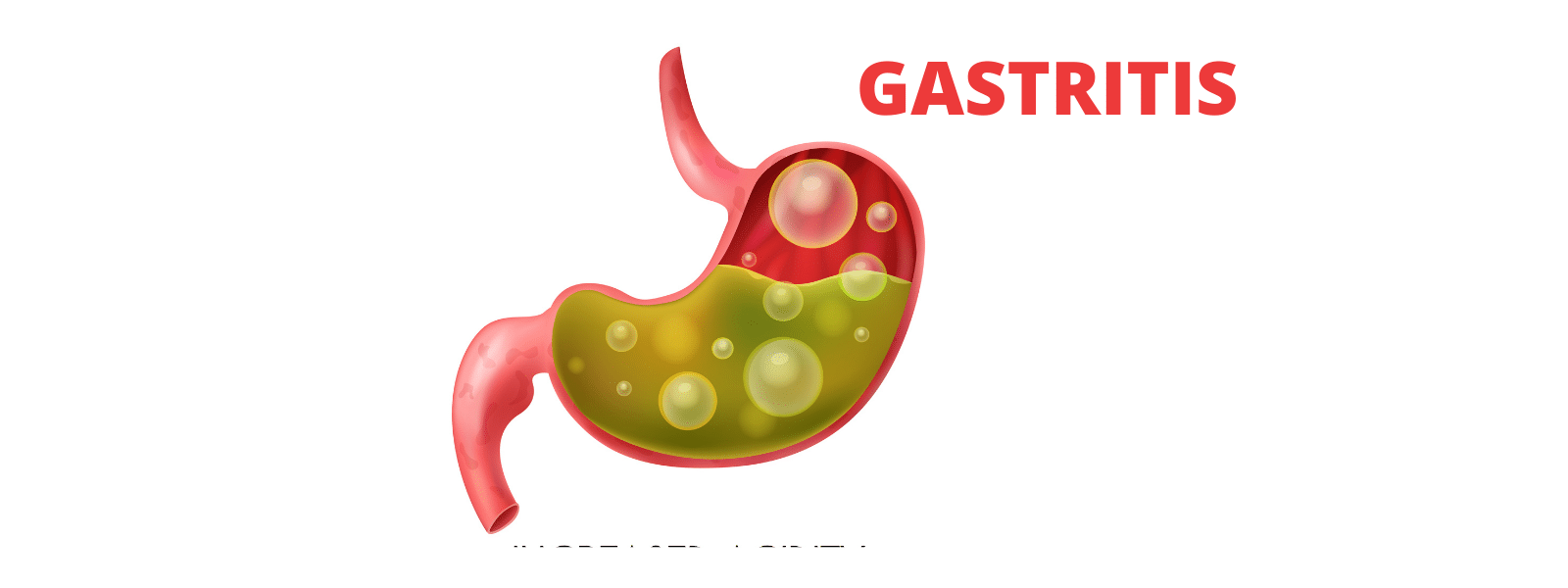 Gastritis: All you need to know
