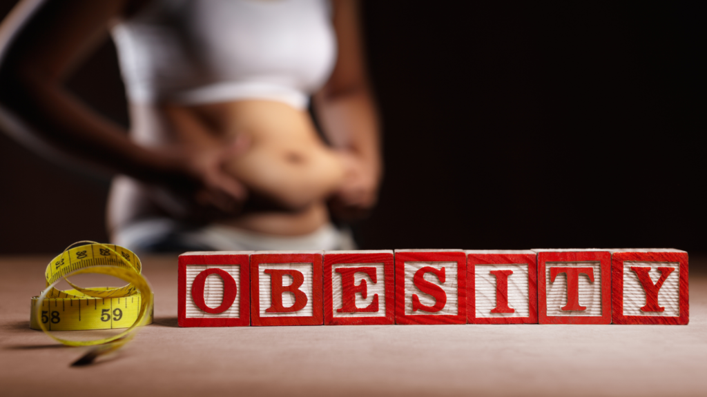 Obesity in PCOS