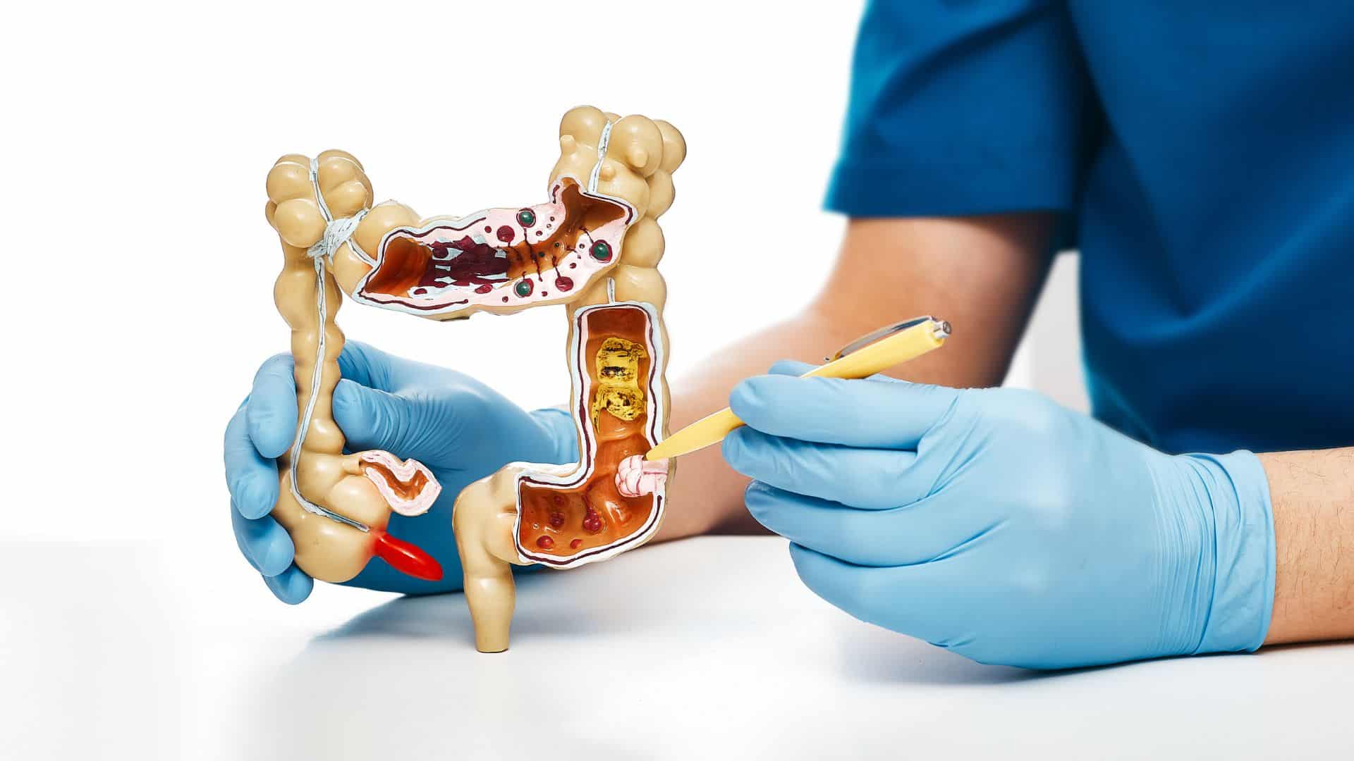 Polypectomy Procedure in Nepal | Clinic One Kathmandu