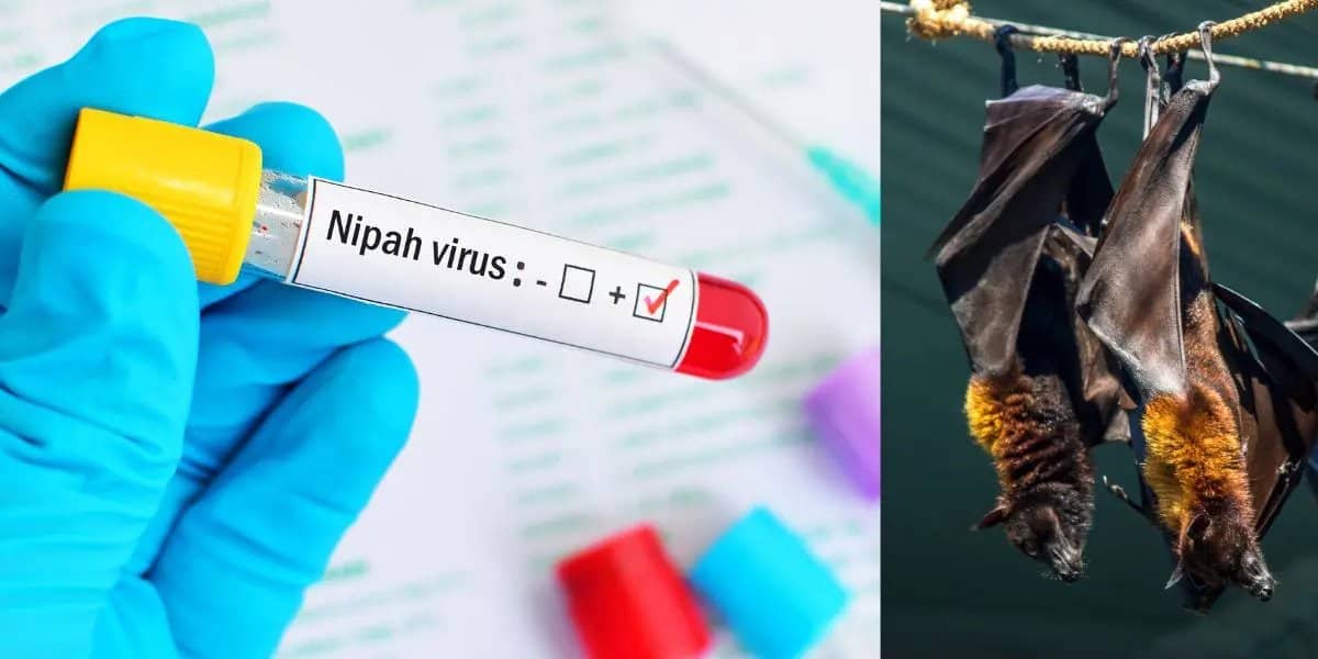 Nipah Virus Outbreaks: What You Need to Know 